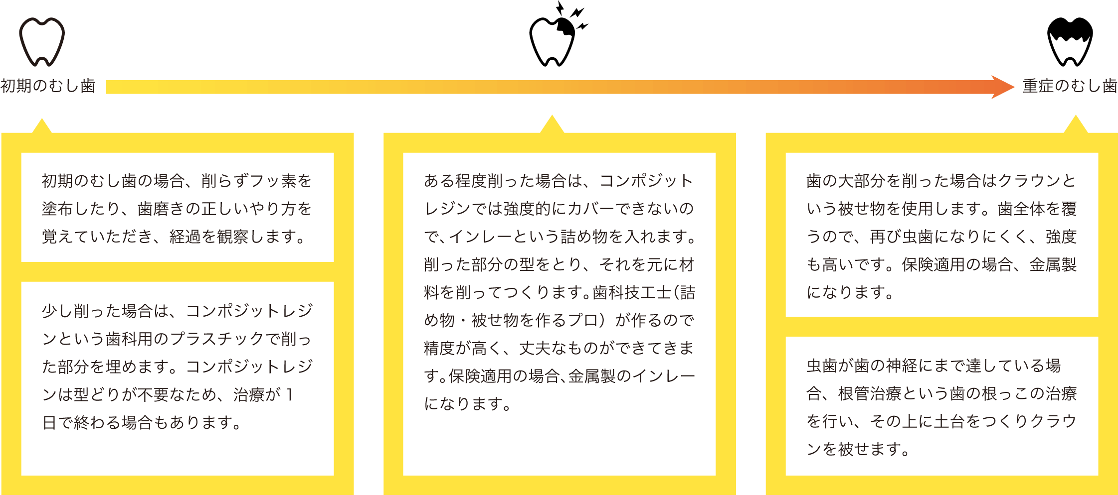 初期のむし歯→重傷のむし歯