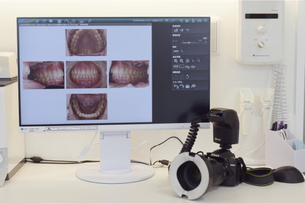 口腔内撮影用一眼レフカメラ