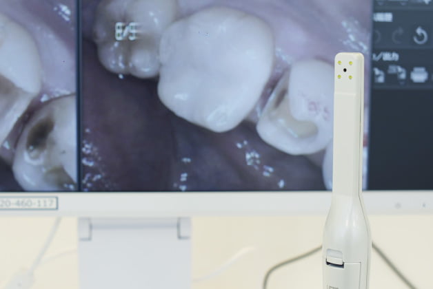 歯科用ワイヤレス口腔内カメラ